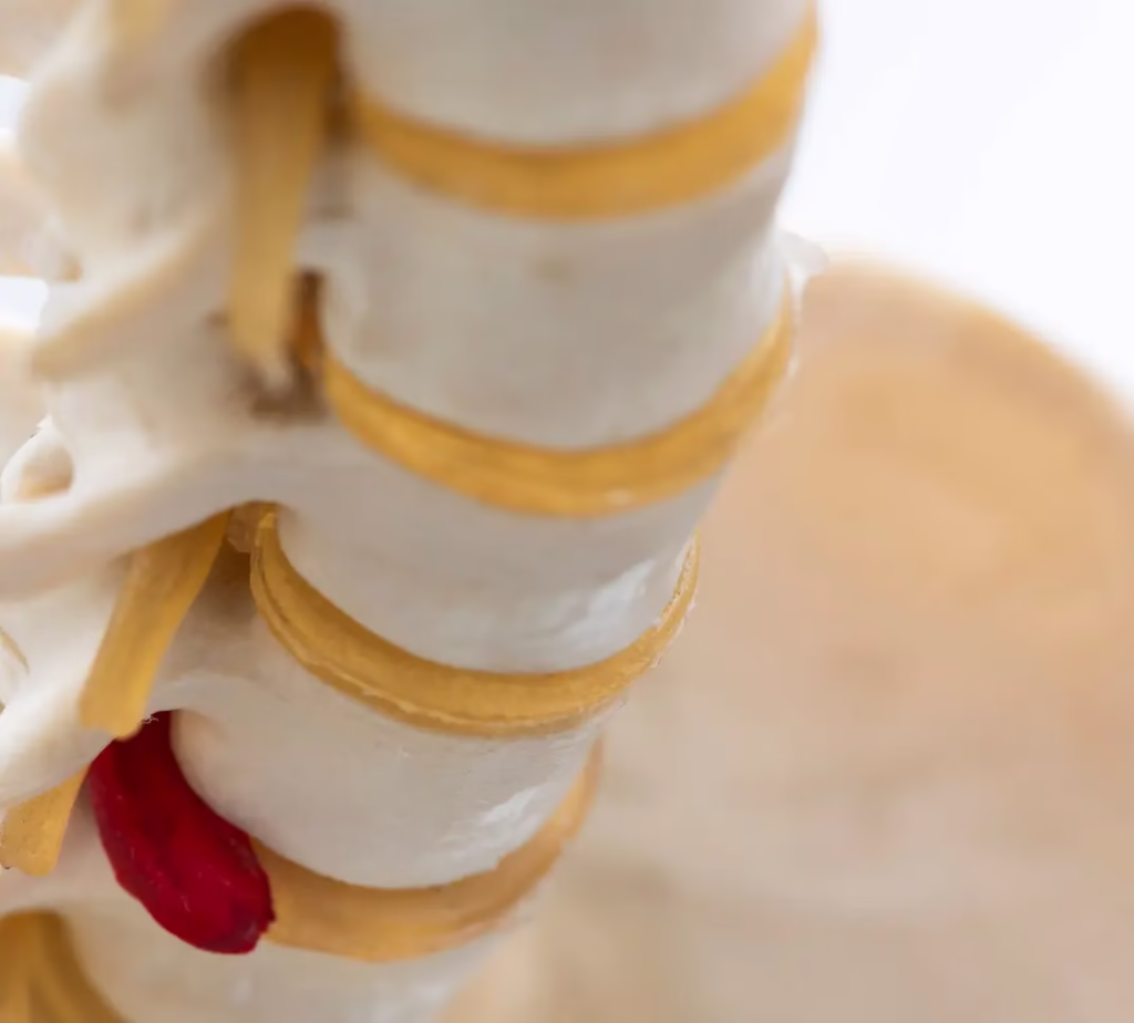 Denizli Bel Fıtığı Tedavisi