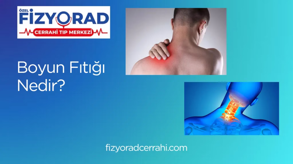 Boyun Fıtığı Nedir ve Neden Olur? – Belirtileri & Tedavisi