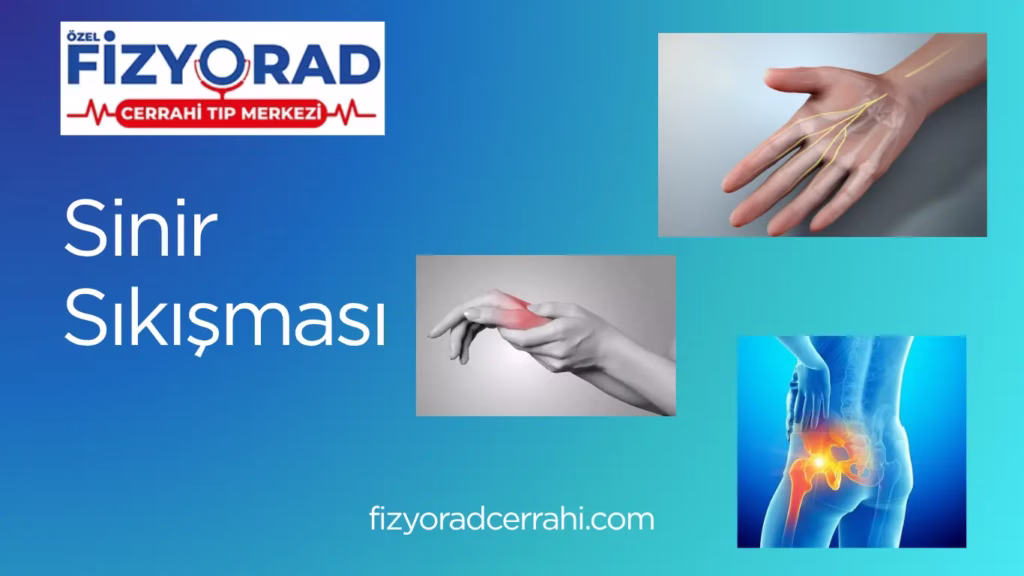 Sinir Sıkışması Nedir? Belirtileri & Tedavi Süreci – Fizyorad